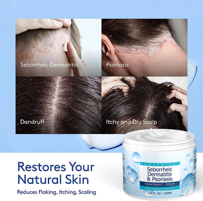 Seborrheic Dermatitis & Psoriasis Relief Cream