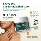 Seborrheic Dermatitis & Psoriasis Relief Cream
