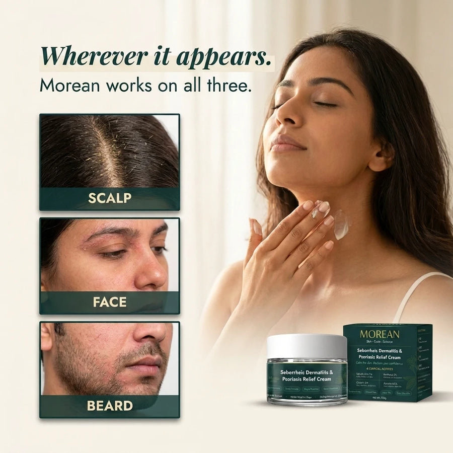 Seborrheic Dermatitis & Psoriasis Relief Cream