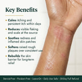 Seborrheic Dermatitis & Psoriasis Relief Cream