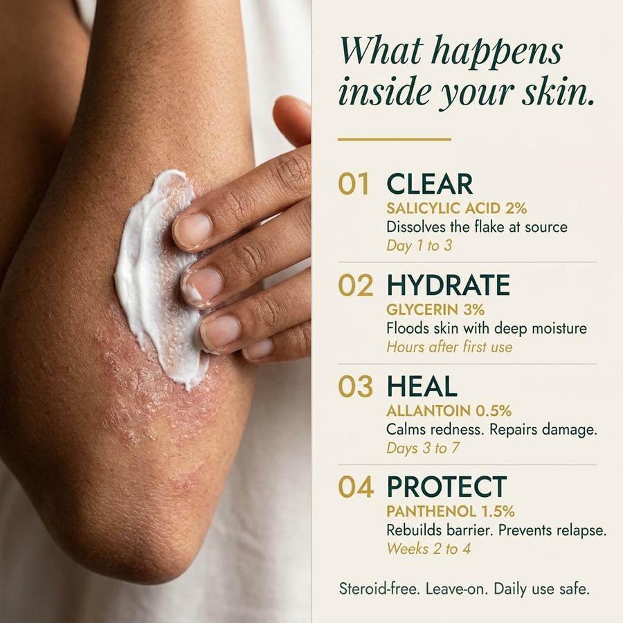 Seborrheic Dermatitis & Psoriasis Relief Cream