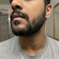 SD Control — The LIPOSTARVE Spot Cream