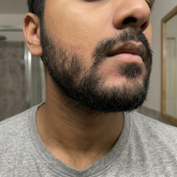 SD Control — The LIPOSTARVE Spot Cream